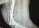 Image showing an X-ray of fractured femur repair on a dog